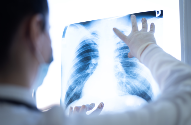 health screening, NHS, employee benefits, wellbeing, preventative, health checks