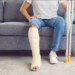 Broken leg, physical health, injury